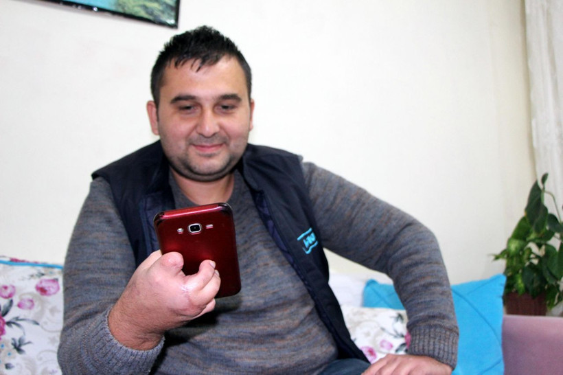 İş kazası geçirince hayatı karardı ayak parmakları eline nakledildi - Resim: 1