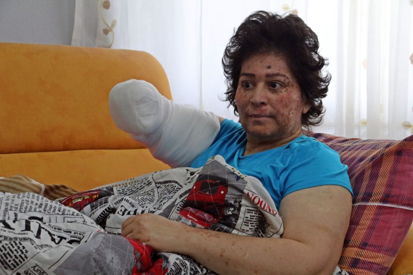 Korona değil güneş eve hapsetti her gün parça parça organları kesiliyor - Resim: 3