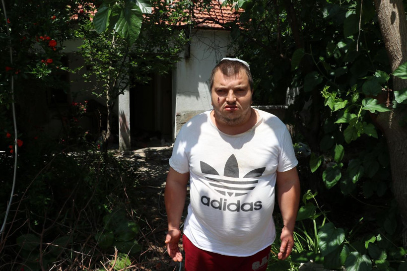 Edirne'de ev sahibinin dayak attığı engelli Sercan yardım bekliyor - Resim: 3