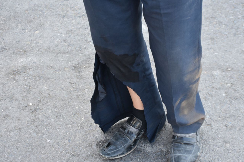 Kurban Bayramı'na acemi kasaplar damga vurdu kendini kesen hastaneye koştu - Resim: 4