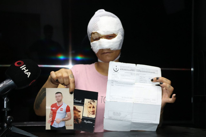 Gaziantep'te cezaevi arkadaşı sevgiliye 7 saat işkence! Uyandığımda tecavüz ediyordu - Resim: 1