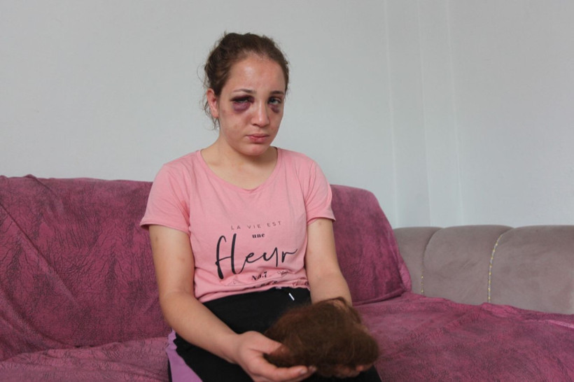 Aydın'da akılalmaz işkence! 3 çocuk annesi kadını bu hale getirdi! - Resim: 3