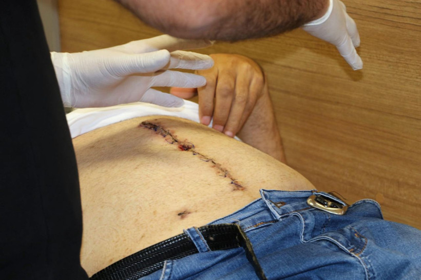 Eskişehir'de ağrıyla gitti karnından 6 kiloluk tümör çıktı - Resim: 3