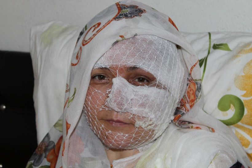 'Seni televizyona çıkaracağım' diyordu! Diyarbakır'da eşini yakan koca bu mesajı atmış - Resim: 2