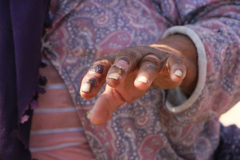 Antalya'da 'yandım yandım diye bağırdım' deyip anlattı: Kaçanlar kilitlenip... - Resim: 4