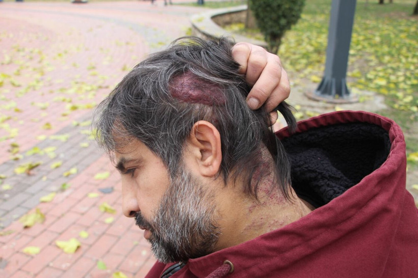 Batman'da 12 yıldır teşhis konulamadı! Kafasında çıktı hayatı karardı: Öldürmüyor süründürüyor - Resim: 4