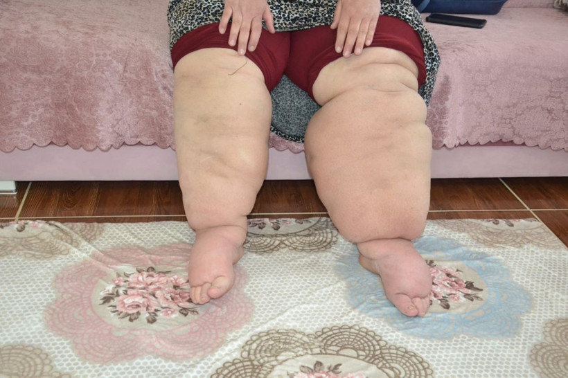 Hayatı kabusa döndü! 15 yıldır hastalığına teşhis koyulmuyor - Resim: 2