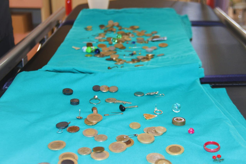 Midelerden çıkanlar şok etti! Ne ararsan var para, iğne, boncuk, pil, yüzük... - Resim: 1