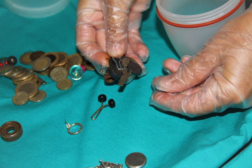 Midelerden çıkanlar şok etti! Ne ararsan var para, iğne, boncuk, pil, yüzük... - Resim: 3