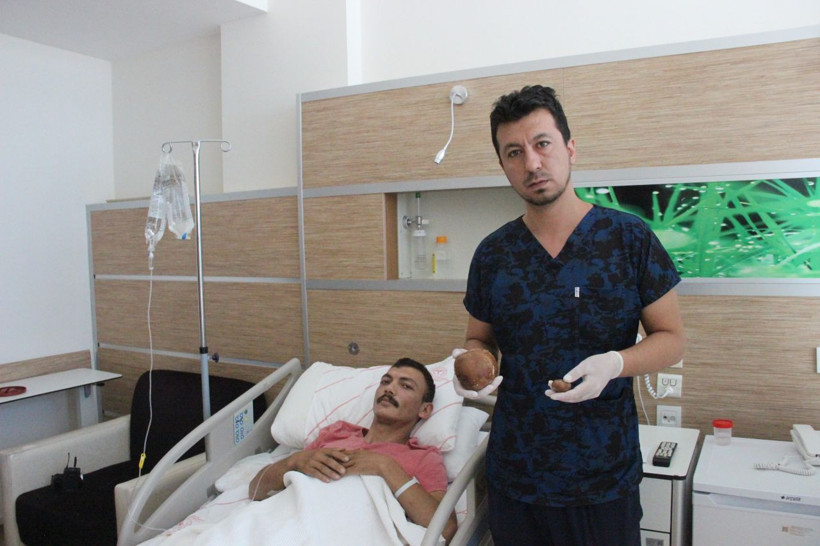 Türkiye'de böylesi görülmedi patatese benziyor Karamanlı gencin mesanesinden çıktı - Resim: 1