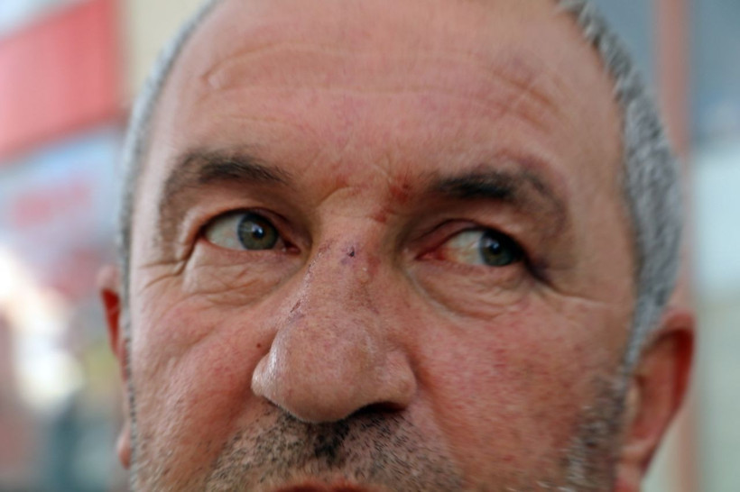 Kulak zarı patlayana kadar dayak diyen adam: "Bu değilmiş" deyip gittiler - Resim: 1