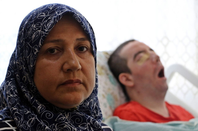 Görme bozukluğuyla başladı! 10 yıldır gözlerini kapatamıyor - Resim: 2