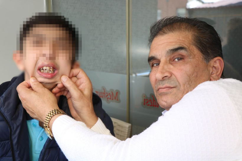 Alt çenesi yok, dişleri üst damağında: Ameliyat için yardım bekliyor - Resim: 2