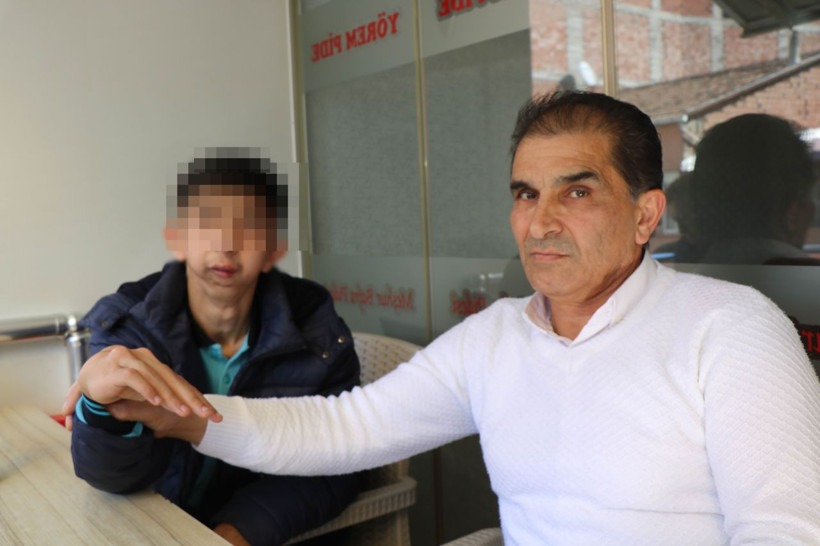 Alt çenesi yok, dişleri üst damağında: Ameliyat için yardım bekliyor - Resim: 1