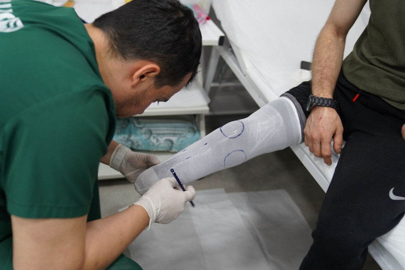 Sokakta yürürken bombanın hedefi oldu, kaybettiği organlarına protezle kavuştu! - Resim: 2