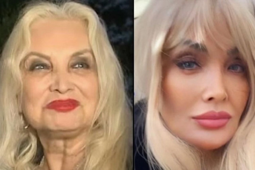 Orhan Gencebay'ın hayat arkadaşı Sevim Emre filtreyi abarttı... - Resim: 1