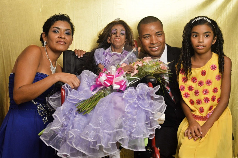 15 yaşında ama 90 gibi görünüyor - Resim: 1