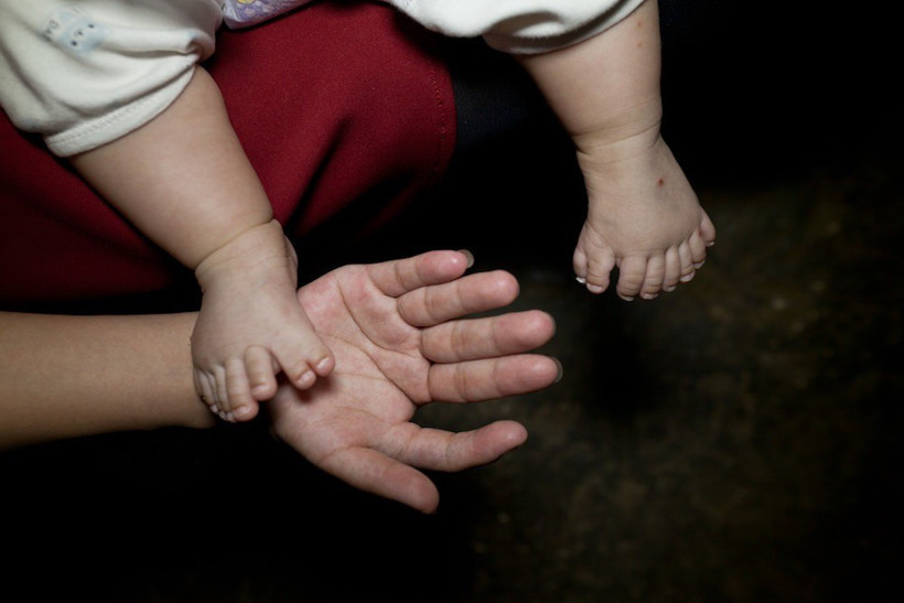 Bu bebeğin tam 31 parmağı var! - Resim: 4