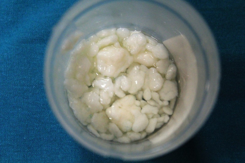 Dizinden 967 adet eklem faresi çıktı! - Resim: 3