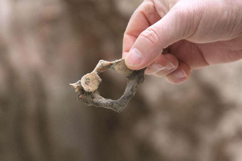 Kanalizasyondan insan kemikleri çıktı - Resim: 1