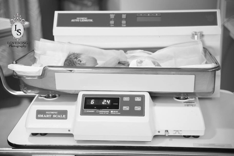 Bebeklerinin kalbi durunca... - Resim: 1