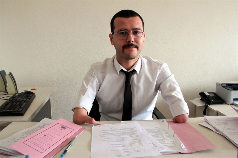 İki yarım kolla doğdu yaptıkları şaşırttı - Resim: 1