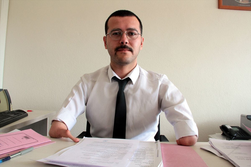 İki yarım kolla doğdu yaptıkları şaşırttı - Resim: 3