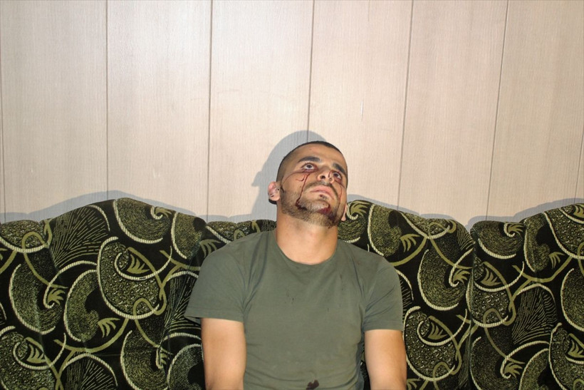 Iraklı genç kan ağlıyor! Hastalığına çare bulunamadı Türkiye'den yardım istedi - Resim: 4