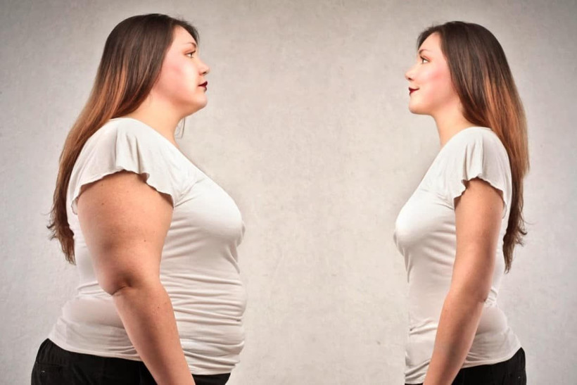 Obez doktor Avustralya'dan gelip kendini Türk hekimlerine emanet etti! - Resim: 4