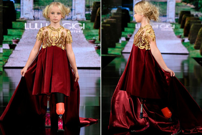 İki ayağı da kesilmiş minik manken tarihe geçti! Fotoğraflar sizi çok sarsacak - Resim: 2