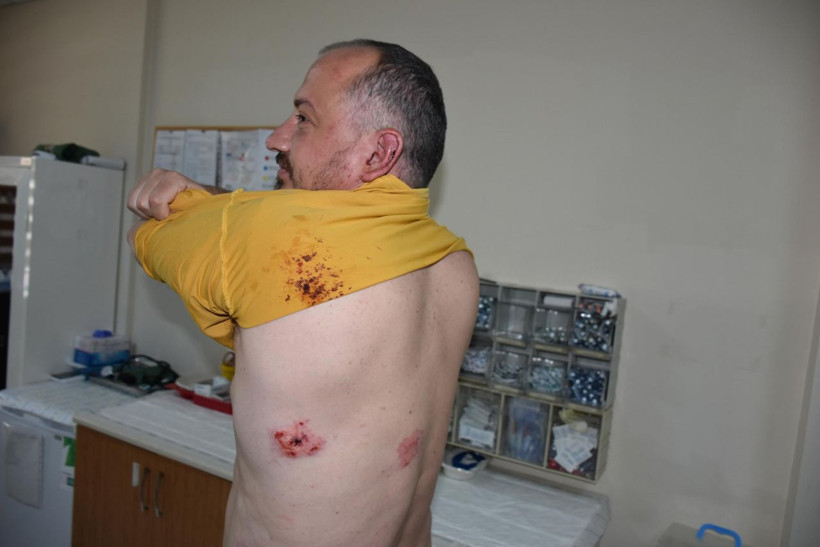 Ünlü gezgin Fatih Koparan'ı feci dövdüler : Beni öldürecekler - Resim: 2