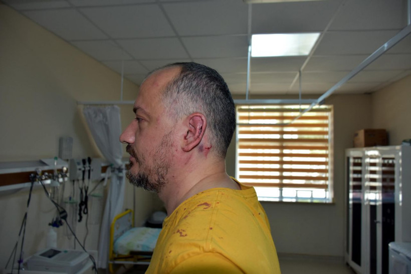 Ünlü gezgin Fatih Koparan'ı feci dövdüler : Beni öldürecekler - Resim: 1