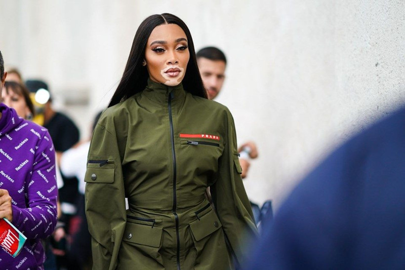 Vitiligo'lu model Winnie Harlow uçak pozu nedeniyle eleştirilere maruz kaldı - Resim: 2