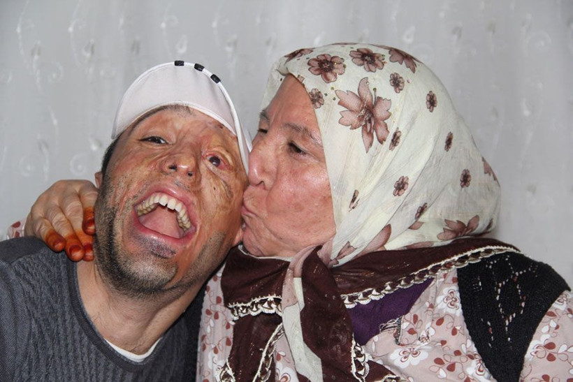 Kafatası yok beyni dışarıda Mehmet Ali'nin çığlığı - Resim: 3