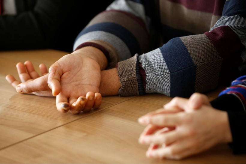 Çift kol nakli yapılan Yusuf Oğuz Şimşek ilk kez kameralar karşısında - Resim: 4