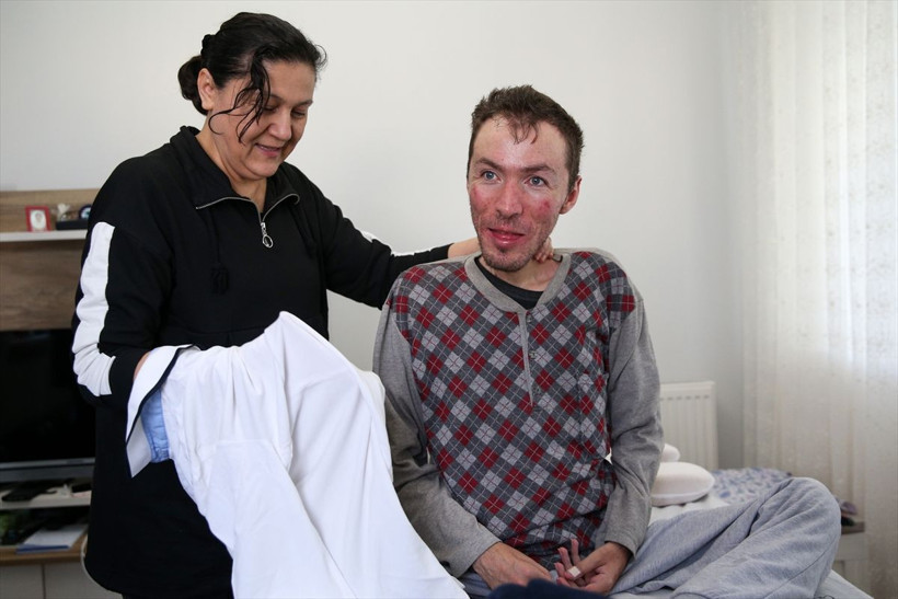 Doktorlar 20 yıl ömür biçti anne ilgisiyle 31 yıldır hayata tutunuyor - Resim: 1