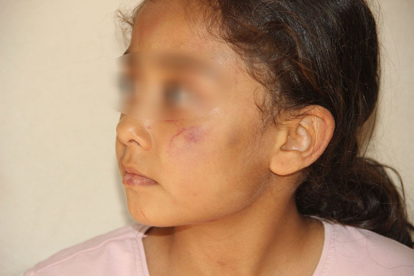 Şanlıurfa'da cani baba vahşeti! 3 çocuğunu eve kapayıp 2 gün boyunca işkence etti - Resim: 2