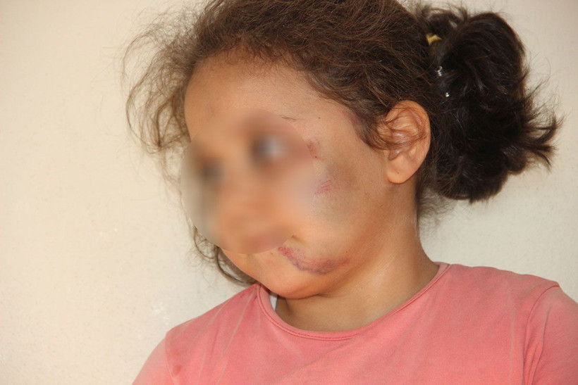 Şanlıurfa'da cani baba vahşeti! 3 çocuğunu eve kapayıp 2 gün boyunca işkence etti - Resim: 3