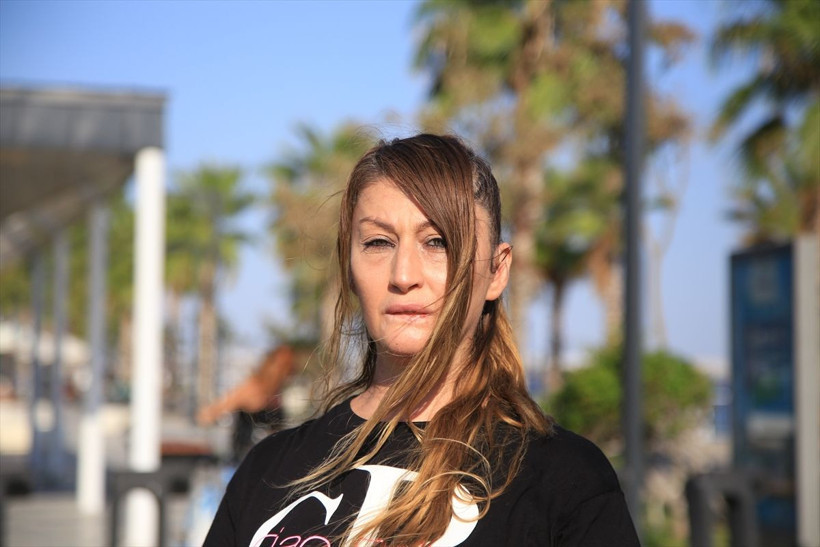 Antalya'da estetik faciası kadının dudağı çürüyerek düştü! - Resim: 2