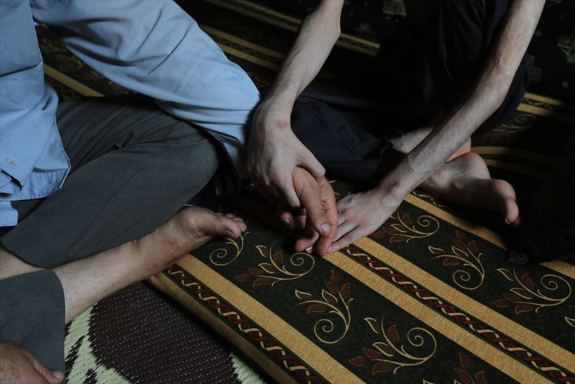 18 yaşındaki Abdullah'ın hali yürekleri burktu! 35 kiloya düştü günden güne eriyor - Resim: 1