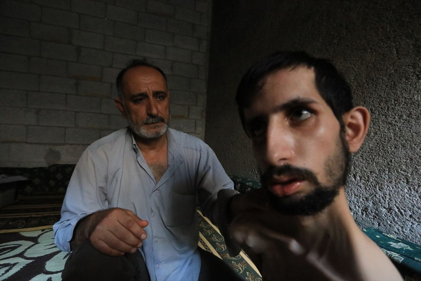 18 yaşındaki Abdullah'ın hali yürekleri burktu! 35 kiloya düştü günden güne eriyor - Resim: 2