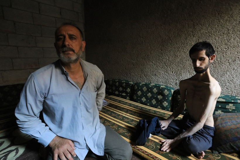 18 yaşındaki Abdullah'ın hali yürekleri burktu! 35 kiloya düştü günden güne eriyor - Resim: 4