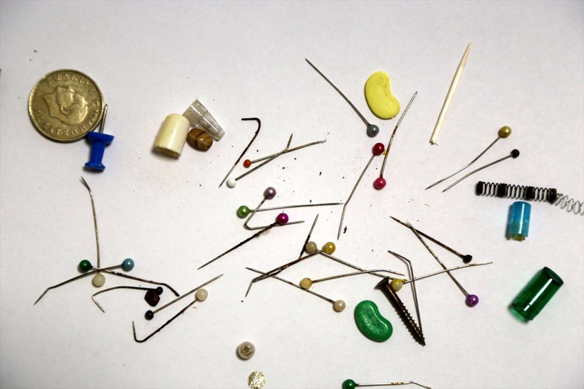 Göğüs cerrahı Ekber Şahin, yanlışlıkla yutulan cisimlerden koleksiyon yaptı! Hepsini ameliyatla çıkardı - Resim: 3