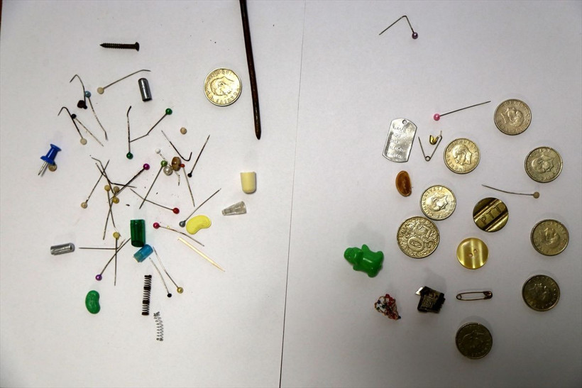 Göğüs cerrahı Ekber Şahin, yanlışlıkla yutulan cisimlerden koleksiyon yaptı! Hepsini ameliyatla çıkardı - Resim: 4