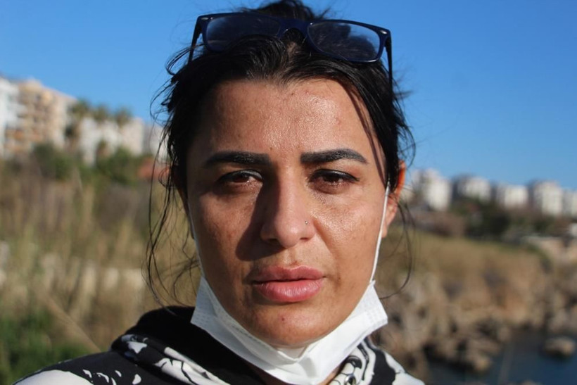 Antalya'da güzellik salonu ilanı hayatının şokunu yaşattı! Yüzünü yaktılar - Resim: 2