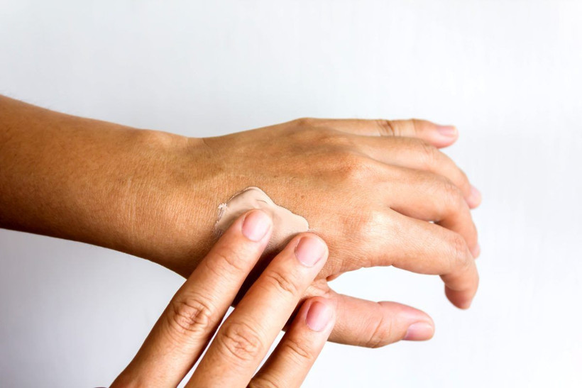 Egzamaya ne iyi gelir tedavisi nötral sabunları kullanın! - Resim: 3