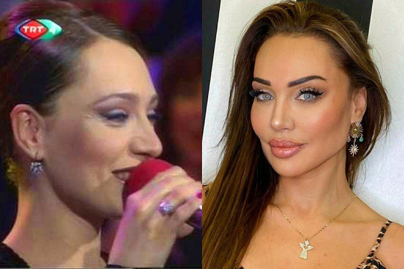 Eski halinden eser kalmadı! Umut Akyürek'in son halini gören tanıyamadı - Resim: 1