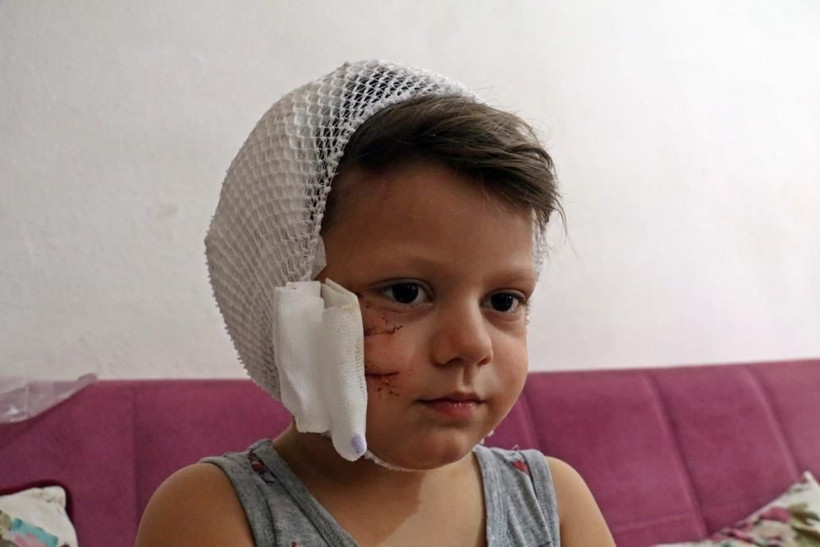 Dokunmak istedi dehşeti yaşadı! Antalya'da köpeğin saldırdığı Yağız ölümden döndü - Resim: 1