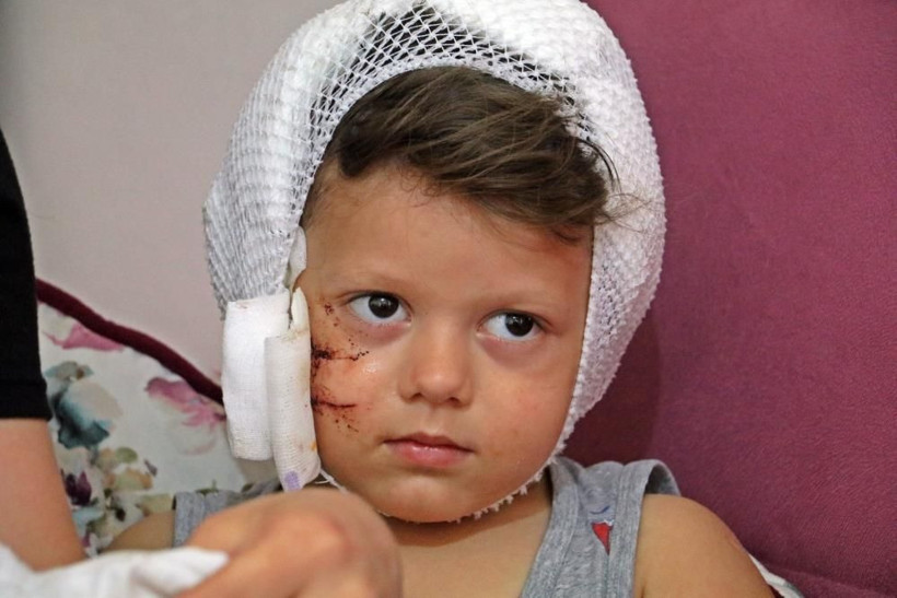 Dokunmak istedi dehşeti yaşadı! Antalya'da köpeğin saldırdığı Yağız ölümden döndü - Resim: 3