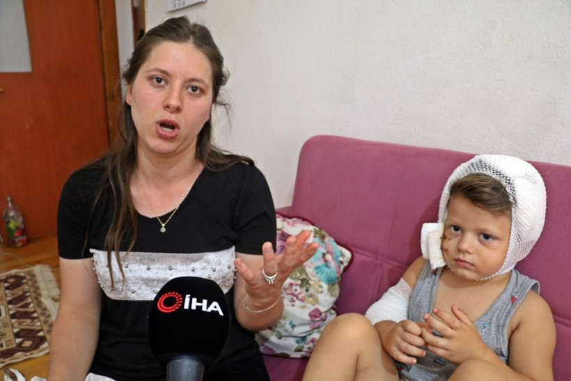 Dokunmak istedi dehşeti yaşadı! Antalya'da köpeğin saldırdığı Yağız ölümden döndü - Resim: 4